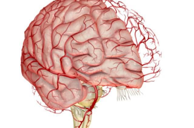 angioencefalopatía focal del cerebro qué es