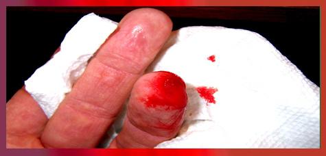 Cómo detener la sangre de un dedo después de que se haya analizado