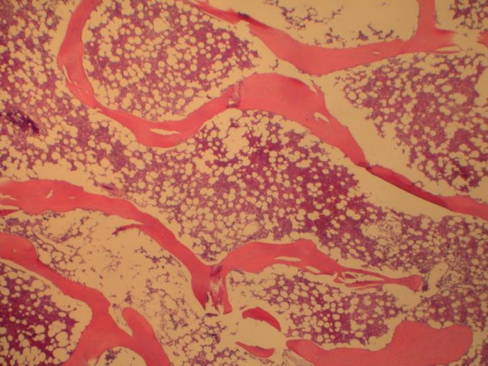 Médula ósea roja: concepto, estructura y función