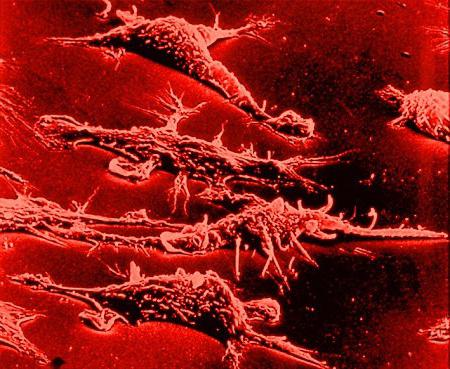 ureaplasma parvum y mycoplasma hominis